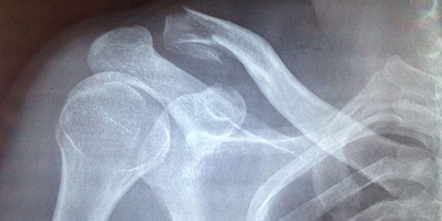 组织工程化骨修复材料临床应用问题与对策